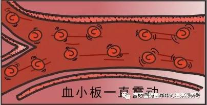 血小板是正常值的三倍？專家提醒小心血栓和出血！