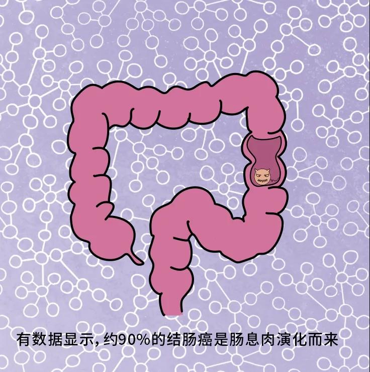 奪走“黑豹”生命的結腸癌，到底什么來頭？