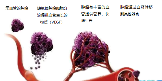 晚期腫瘤為什么會復發(fā)轉(zhuǎn)移？