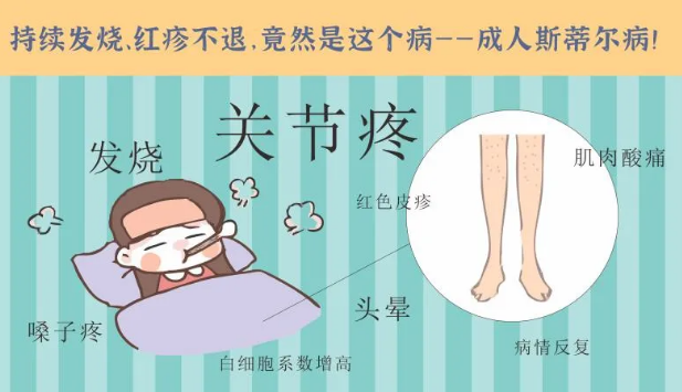 持續(xù)發(fā)燒、紅疹不退……她終于在這里治好了這個罕見病