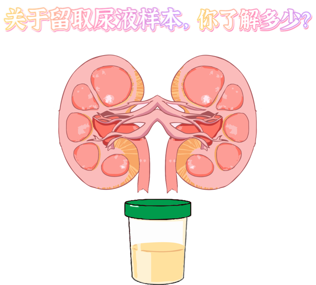 做尿檢，不得不說的注意事項(xiàng)！