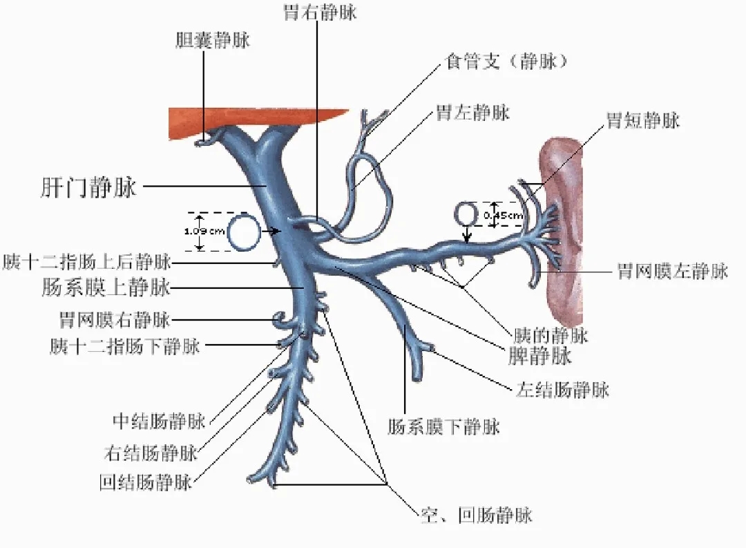 反復(fù)嘔血、黑便怎么辦？TIPS手術(shù)能解決