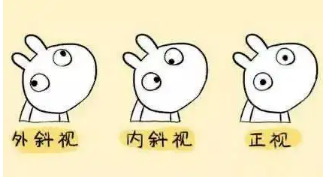 小baby老歪著頭？警惕斜頸! 這樣糾正……