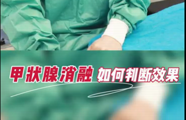 甲狀腺消融如何判斷效果？
