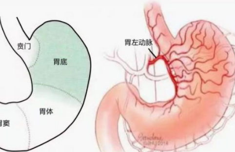 不開刀不吃藥不餓肚子，微創(chuàng)介入減肥靠譜嗎？