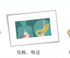 關(guān)愛身體健康，輕松檢查胃腸