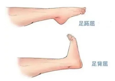 扭胯小連步、動(dòng)感搖花手……“科目三”雖火，運(yùn)動(dòng)損傷也要防！